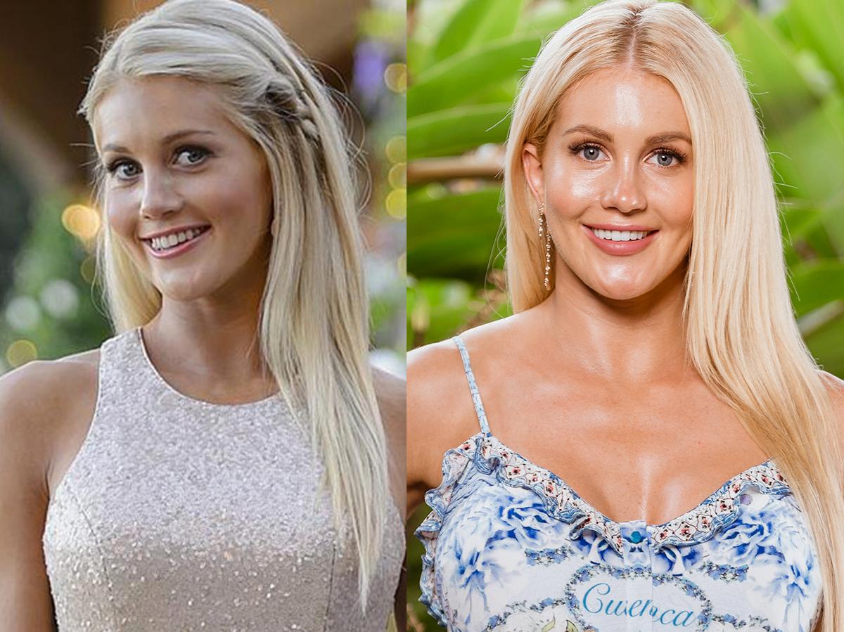 Bachelorette Ali Oetjen regrets getting plastic surgery to impress ex