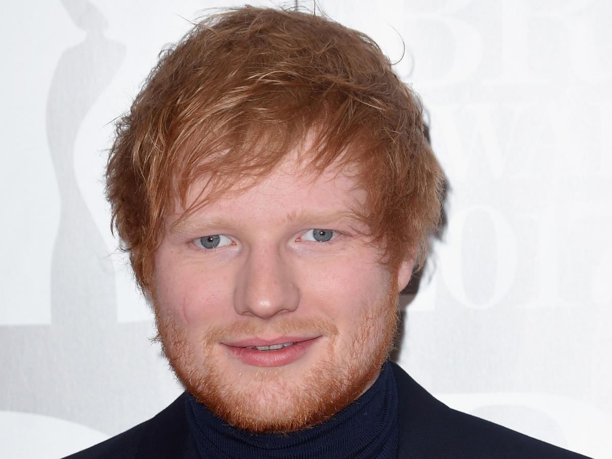 James Blunt Calls Bullsh*t On Ed Sheeran’s I-was-cut-in-the-face-with-a 