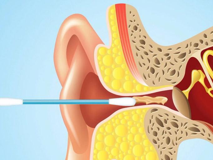 EAR CANAL Ear Canal