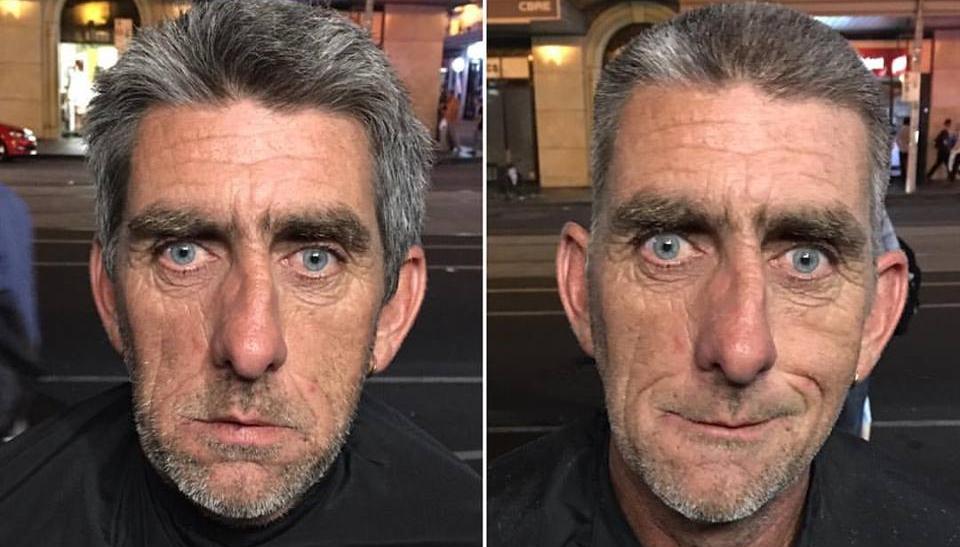 The Amazing Story Behind This Before And After Photo Fiveaa