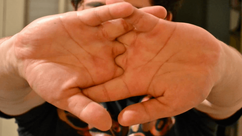 Here's what actually happens when you crack your knuckles