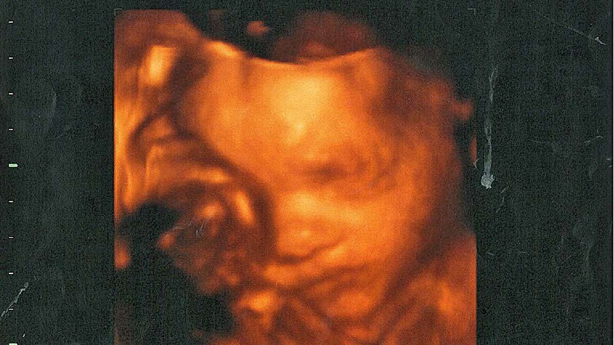 Is Your 9 Week Old Baby Pregnancy Showing This? Doctors Shocked! - uy7h06o