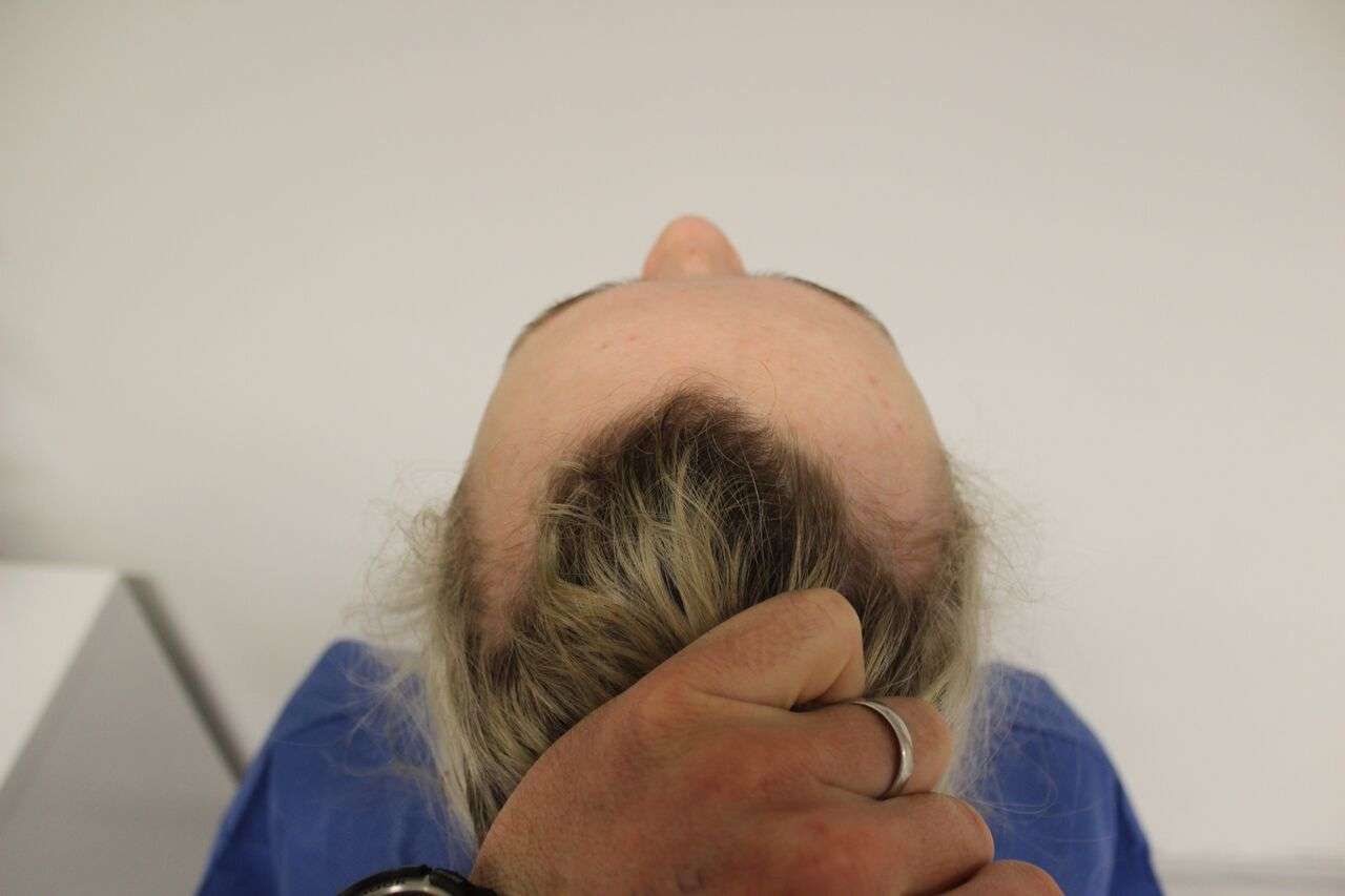 The Horrible Effects A Ballerina Bun Has On Your Hair Nova 100