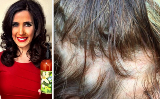 Women Are Losing Hair After Using Popular Hair Care Line Nova 969